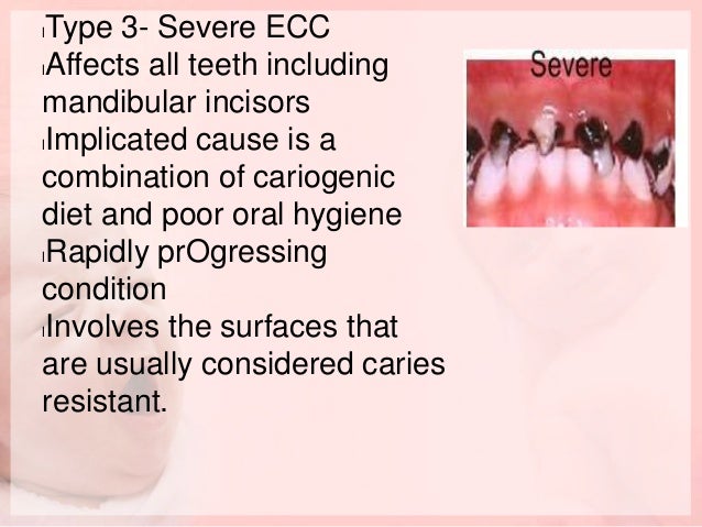 Nursing bottle caries and rampant caries