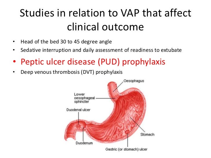 Superbugs and Bundles of Care