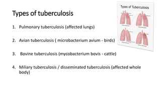 Types of tuberculosis
1. Pulmonary tuberculosis (affected lungs)
2. Avian tuberculosis ( microbacterium avium - birds)
3. Bovine tuberculosis (mycobacterium bovis - cattle)
4. Miliary tuberculosis / disseminated tuberculosis (affected whole
body)
 