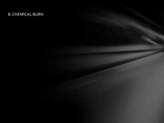 Nursing care management of BURNS in ER | PPTX