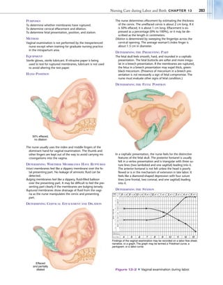 Effacement Testing Nursing care of breech delivery | PDF