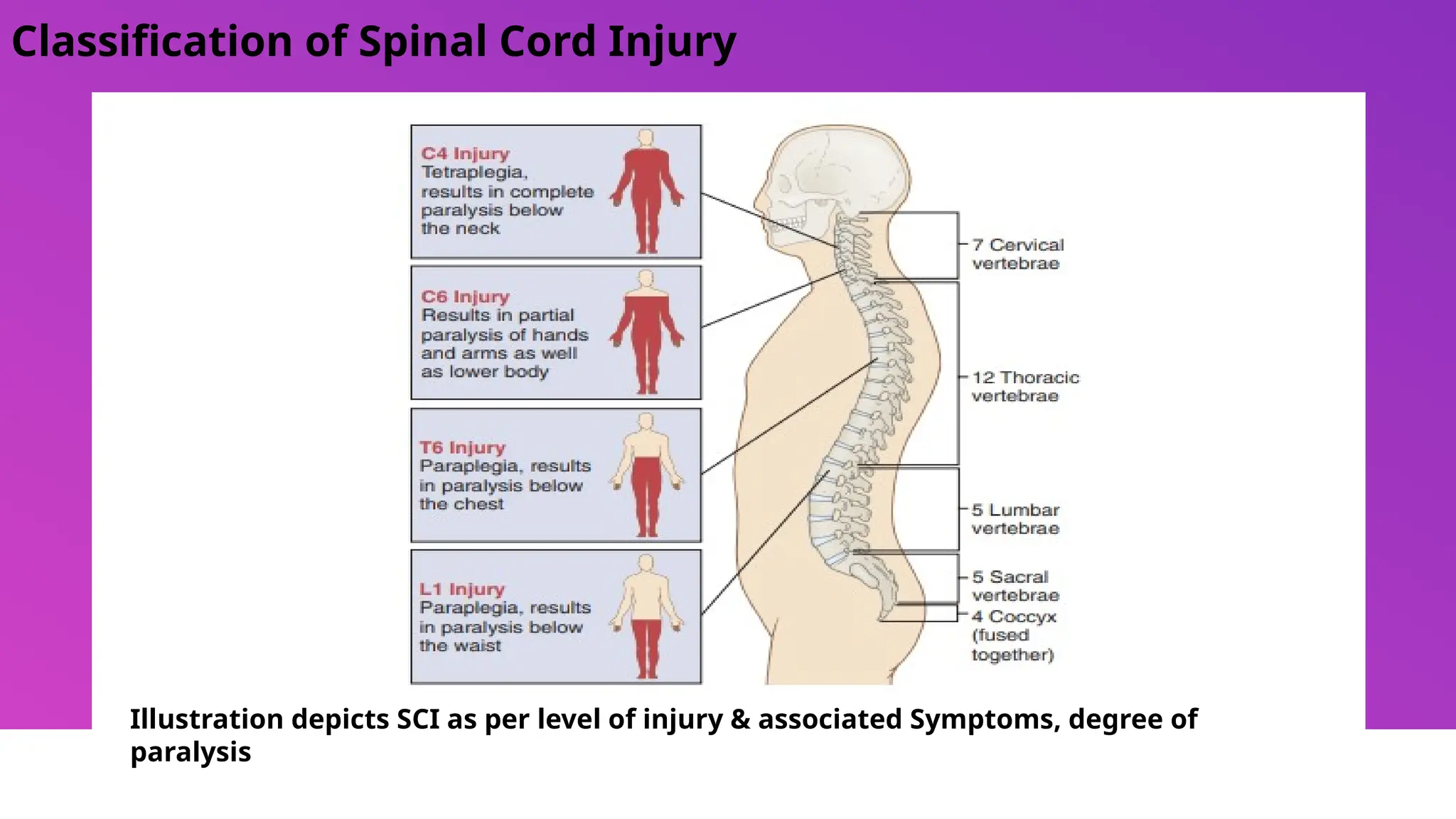 Nursing care of patient with spinal cord injury.pptx