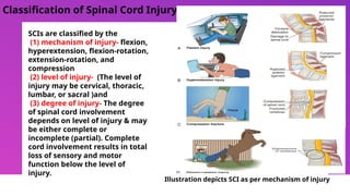 Nursing care of patient with spinal cord injury.pptx