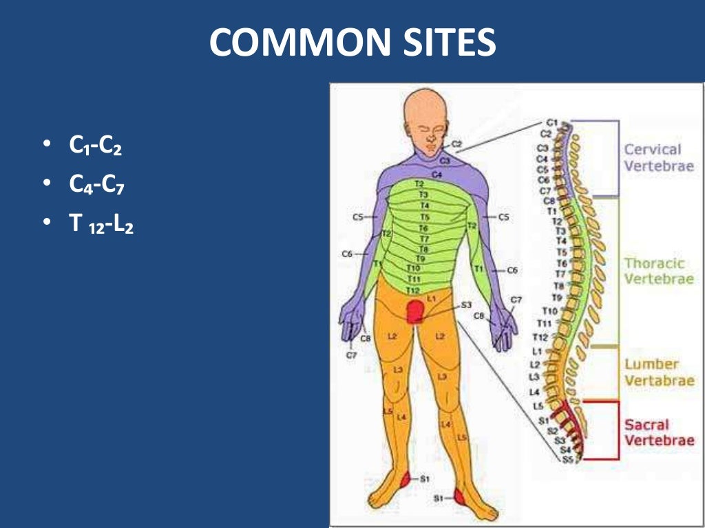 Nursing care of spinal cord injury