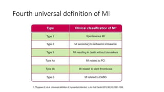 Fourth universal definition of MI
 