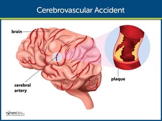 Pathophysiology
The disruption in the blood flow initiates a complex series of cellular metabolic events.
 