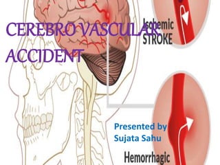 CEREBRO VASCULAR
ACCIDENT
Presented by
Sujata Sahu
 