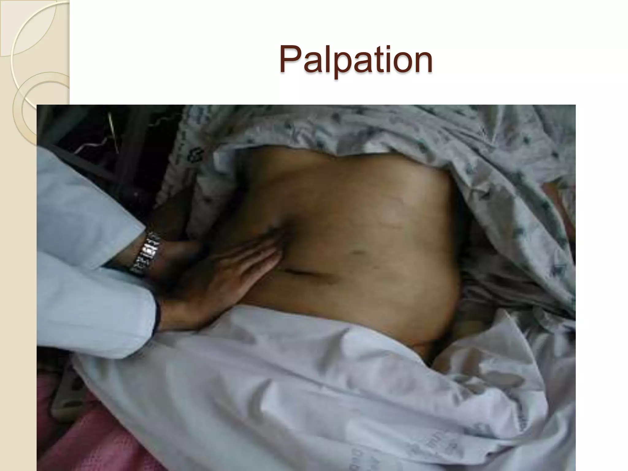 Palpation
 