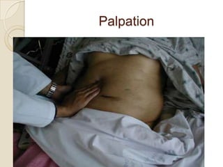 Palpation
 