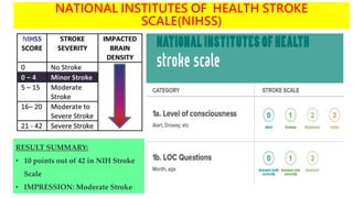 NATIONAL INSTITUTES OF HEALTH STROKE
SCALE(NIHSS)
RESULT SUMMARY:
• 10 points out of 42 in NIH Stroke
Scale
• IMPRESSION: Moderate Stroke
 