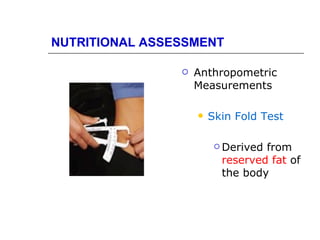 NUTRITIONAL ASSESSMENT

                   Anthropometric
                    Measurements

                       Skin Fold Test

                          Derivedfrom
                          reserved fat of
                          the body
 
