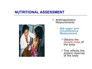 NUTRITIONAL ASSESSMENT
                   Anthropometric
                    Measurements

                       Mid-upper arm
                        Circumference
                        Measurement

                            Obtains the
                             muscle mass of
                             the body

                            This reflects the
                             protein reserves
                             of the body
 