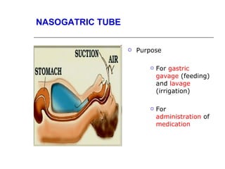 NASOGATRIC TUBE


                     Purpose

                            For gastric
                             gavage (feeding)
                             and lavage
                             (irrigation)

                            For
                             administration of
                             medication
 