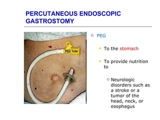 PERCUTANEOUS ENDOSCOPIC
GASTROSTOMY

                  PEG

                      To the stomach

                      To provide nutrition
                       to

                            Neurologic
                             disorders such as
                             a stroke or a
                             tumor of the
                             head, neck, or
                             esophagus
 