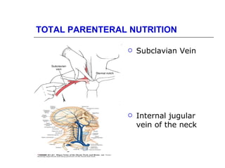 TOTAL PARENTERAL NUTRITION

                   Subclavian Vein




                   Internal jugular
                    vein of the neck
 