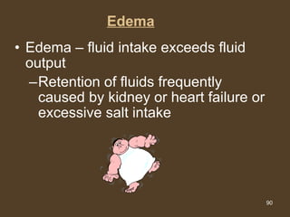 Edema Edema – fluid intake exceeds fluid output Retention of fluids frequently caused by kidney or heart failure or excessive salt intake 