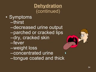 Dehydration (continued) Symptoms thirst decreased urine output parched or cracked lips dry, cracked skin fever weight loss concentrated urine tongue coated and thick 