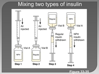 Figure 33-35 Mixing two types of insulin 