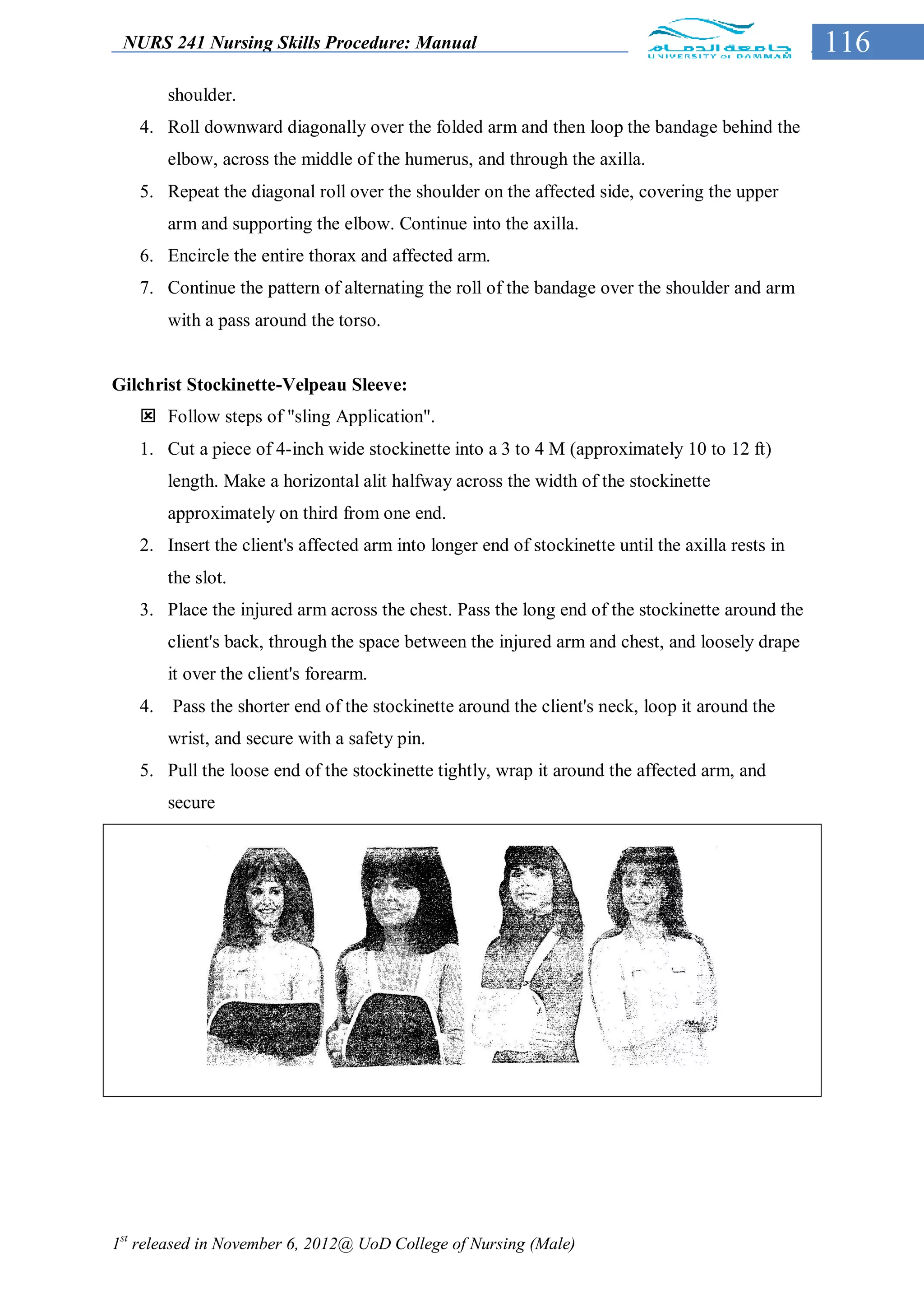 NURS 241 Nursing Skills Procedure: Manual                                                        116
        shoulder.
   4. Roll downward diagonally over the folded arm and then loop the bandage behind the
        elbow, across the middle of the humerus, and through the axilla.
   5. Repeat the diagonal roll over the shoulder on the affected side, covering the upper
        arm and supporting the elbow. Continue into the axilla.
   6. Encircle the entire thorax and affected arm.
   7. Continue the pattern of alternating the roll of the bandage over the shoulder and arm
        with a pass around the torso.


Gilchrist Stockinette-Velpeau Sleeve:
    Follow steps of "sling Application".
   1. Cut a piece of 4-inch wide stockinette into a 3 to 4 M (approximately 10 to 12 ft)
        length. Make a horizontal alit halfway across the width of the stockinette
        approximately on third from one end.
   2. Insert the client's affected arm into longer end of stockinette until the axilla rests in
        the slot.
   3. Place the injured arm across the chest. Pass the long end of the stockinette around the
        client's back, through the space between the injured arm and chest, and loosely drape
        it over the client's forearm.
   4.   Pass the shorter end of the stockinette around the client's neck, loop it around the
        wrist, and secure with a safety pin.
   5. Pull the loose end of the stockinette tightly, wrap it around the affected arm, and
        secure




1st released in November 6, 2012@ UoD College of Nursing (Male)
 