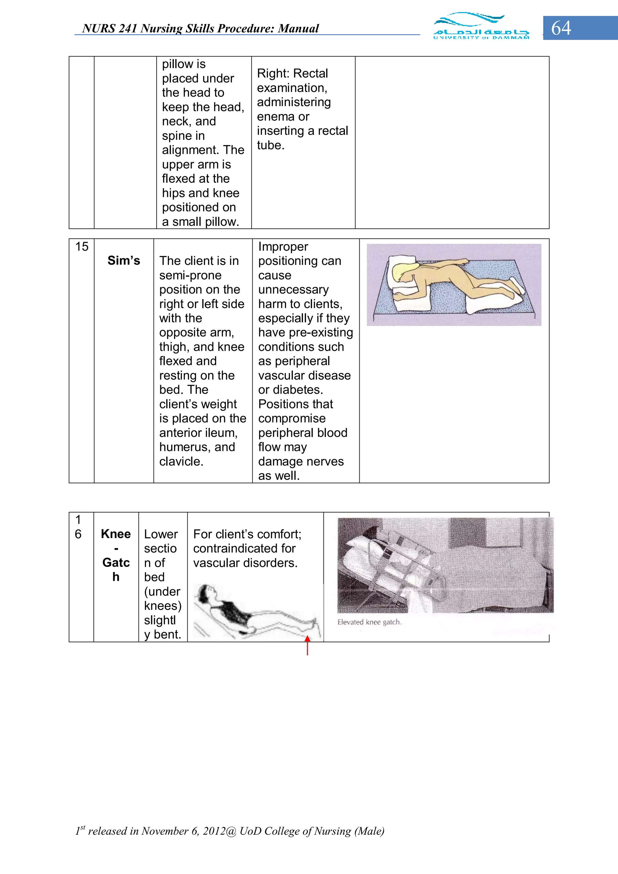 NURS 241 Nursing Skills Procedure: Manual                     64
                   pillow is
                   placed under        Right: Rectal
                   the head to         examination,
                   keep the head,      administering
                   neck, and           enema or
                   spine in            inserting a rectal
                   alignment. The      tube.
                   upper arm is
                   flexed at the
                   hips and knee
                   positioned on
                   a small pillow.

15                                     Improper
        Sim’s     The client is in     positioning can
                  semi-prone           cause
                  position on the      unnecessary
                  right or left side   harm to clients,
                  with the             especially if they
                  opposite arm,        have pre-existing
                  thigh, and knee      conditions such
                  flexed and           as peripheral
                  resting on the       vascular disease
                  bed. The             or diabetes.
                  client’s weight      Positions that
                  is placed on the     compromise
                  anterior ileum,      peripheral blood
                  humerus, and         flow may
                  clavicle.            damage nerves
                                       as well.


1
6      Knee     Lower For client’s comfort;
         -      sectio contraindicated for
       Gatc     n of    vascular disorders.
        h       bed
                (under
                knees)
                slightl
                y bent.




1st released in November 6, 2012@ UoD College of Nursing (Male)
 