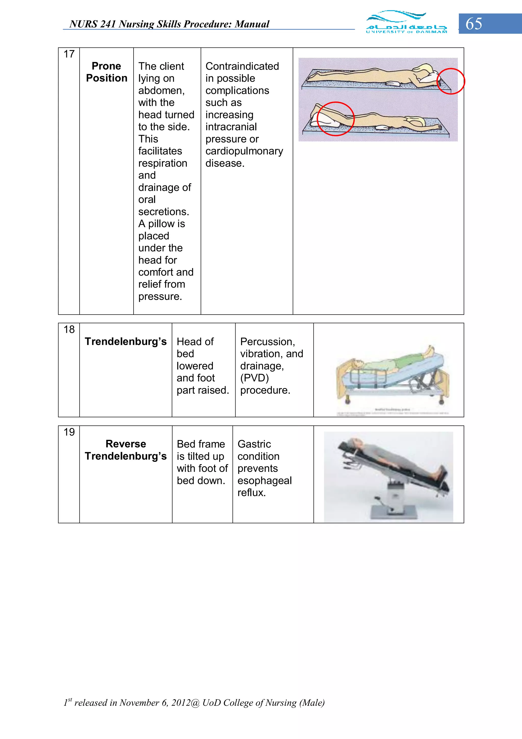 NURS 241 Nursing Skills Procedure: Manual                        65
17
      Prone       The client      Contraindicated
     Position     lying on        in possible
                  abdomen,        complications
                  with the        such as
                  head turned     increasing
                  to the side.    intracranial
                  This            pressure or
                  facilitates     cardiopulmonary
                  respiration     disease.
                  and
                  drainage of
                  oral
                  secretions.
                  A pillow is
                  placed
                  under the
                  head for
                  comfort and
                  relief from
                  pressure.


18
     Trendelenburg’s Head of              Percussion,
                     bed                  vibration, and
                     lowered              drainage,
                     and foot             (PVD)
                     part raised.         procedure.


19
         Reverse     Bed frame           Gastric
     Trendelenburg’s is tilted up        condition
                     with foot of        prevents
                     bed down.           esophageal
                                         reflux.




1st released in November 6, 2012@ UoD College of Nursing (Male)
 