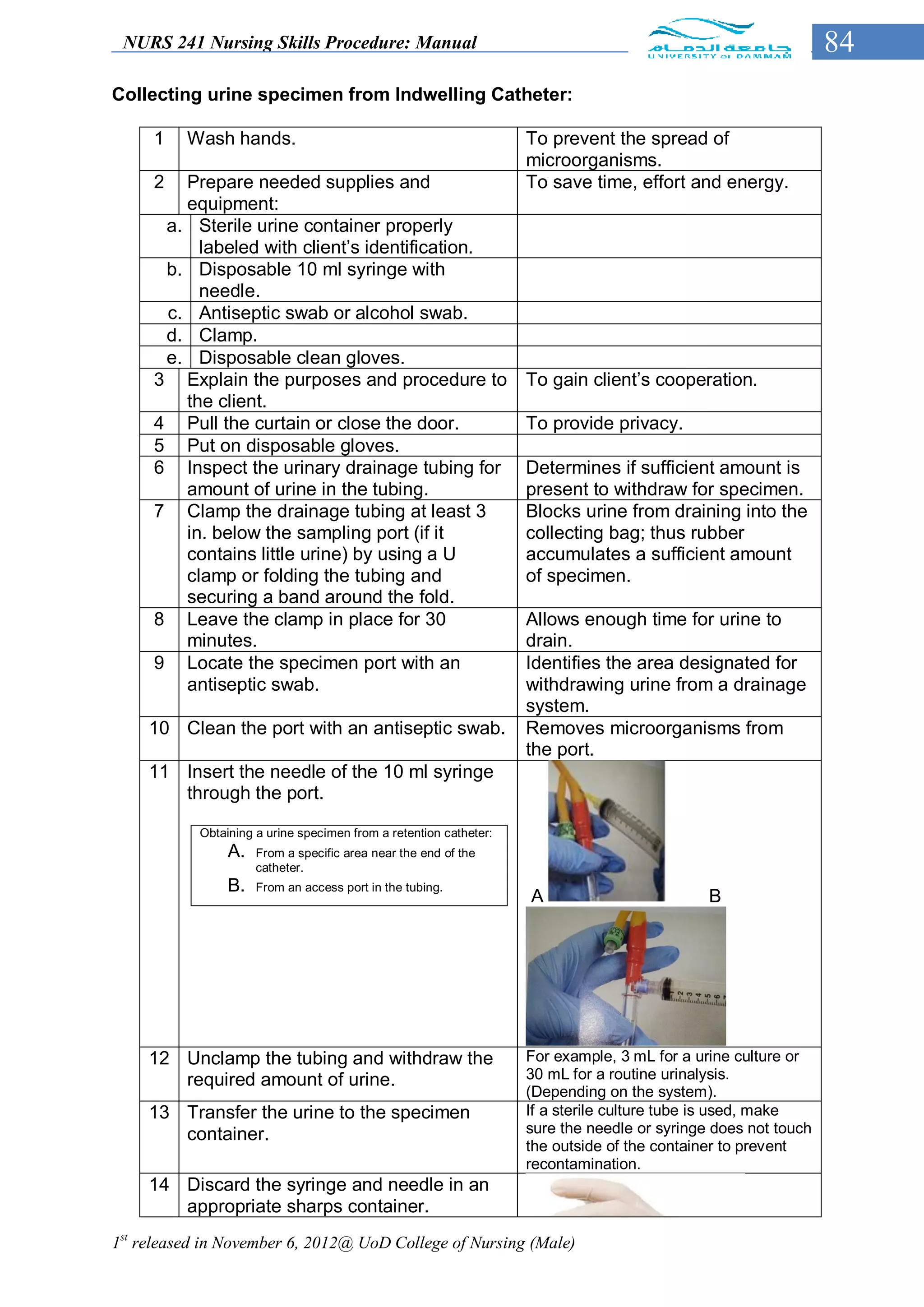 NURS 241 Nursing Skills Procedure: Manual                                                                     84
Collecting urine specimen from Indwelling Catheter:

     1    Wash hands.                                              To prevent the spread of
                                                                   microorganisms.
     2  Prepare needed supplies and                                To save time, effort and energy.
        equipment:
      a. Sterile urine container properly
          labeled with client’s identification.
      b. Disposable 10 ml syringe with
          needle.
      c. Antiseptic swab or alcohol swab.
      d. Clamp.
      e. Disposable clean gloves.
     3 Explain the purposes and procedure to                       To gain client’s cooperation.
        the client.
     4 Pull the curtain or close the door.                         To provide privacy.
     5 Put on disposable gloves.
     6 Inspect the urinary drainage tubing for                     Determines if sufficient amount is
        amount of urine in the tubing.                             present to withdraw for specimen.
     7 Clamp the drainage tubing at least 3                        Blocks urine from draining into the
        in. below the sampling port (if it                         collecting bag; thus rubber
        contains little urine) by using a U                        accumulates a sufficient amount
        clamp or folding the tubing and                            of specimen.
        securing a band around the fold.
     8 Leave the clamp in place for 30                             Allows enough time for urine to
        minutes.                                                   drain.
     9 Locate the specimen port with an                            Identifies the area designated for
        antiseptic swab.                                           withdrawing urine from a drainage
                                                                   system.
     10 Clean the port with an antiseptic swab.                    Removes microorganisms from
                                                                   the port.
     11 Insert the needle of the 10 ml syringe
        through the port.

           Obtaining a urine specimen from a retention catheter:
                A.   From a specific area near the end of the
                     catheter.
                B.   From an access port in the tubing.
                                                                   A                         B




     12 Unclamp the tubing and withdraw the                        For example, 3 mL for a urine culture or
        required amount of urine.                                  30 mL for a routine urinalysis.
                                                                   (Depending on the system).
     13 Transfer the urine to the specimen                         If a sterile culture tube is used, make
        container.                                                 sure the needle or syringe does not touch
                                                                   the outside of the container to prevent
                                                                   recontamination.
     14 Discard the syringe and needle in an
        appropriate sharps container.
1st released in November 6, 2012@ UoD College of Nursing (Male)
 