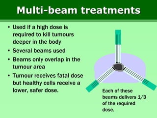 Multi-beam treatments
• Used if a high dose is
required to kill tumours
deeper in the body
• Several beams used
• Beams only overlap in the
tumour area
• Tumour receives fatal dose
but healthy cells receive a
lower, safer dose. Each of these
beams delivers 1/3
of the required
dose.
 
