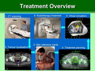Treatment Overview
 