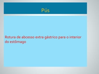 Pús 
Rotura de abcesso extra gástrico para o interior 
do estômago 
 