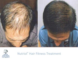 Nutriol® Hair Fitness Treatment

 