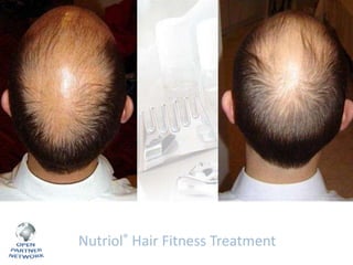 Nutriol® Hair Fitness Treatment

 