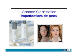Gamme Clear Action
Imperfections de peau
 