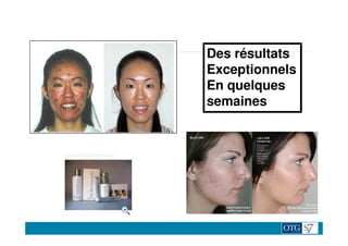 Des résultats
Exceptionnels
En quelques
semaines
 