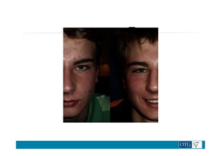 Nuskin visage photos