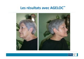 Les résultats avec AGELOC™
TRAITENON TRAITE
Après 90 jpurs de traitement
Résultats variables selon les personnes.
 