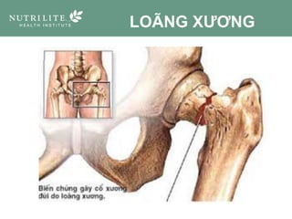 LOÃNG XƯƠNG
 
