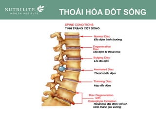 THOÁI HÓA ĐỐT SỐNG
 