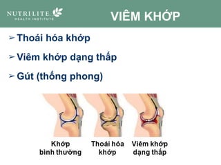 VIÊM KHỚP
➢ Thoái hóa khớp
➢ Viêm khớp dạng thấp
➢ Gút (thống phong)
 