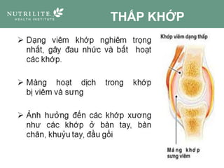 THẤP KHỚP
 