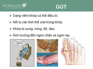 GÚT
 