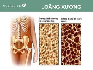 LOÃNG XƯƠNG
 