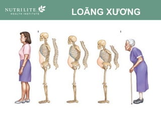 LOÃNG XƯƠNG
 