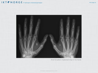IT-næringens interesseorganisasjon ikt-norge.no
http://s.telegraph.co.uk/graphics/projects/the-future-is-android/
Amal Graafstra implanted chips in his hands
 