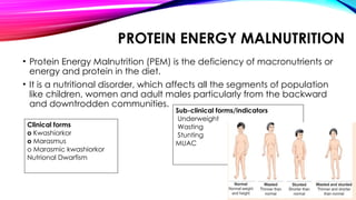 Comprehensive Overview of Protein Energy Malnutrition and Nutritional ...