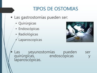 TIPOS DE OSTOMIAS
 Las gastrostomías pueden ser:
• Quirúrgicas
• Endoscópicas
• Radiológicas
• Laparoscopicas
 Las yeyunostomías pueden ser
quirúrgicas, endoscópicas y
laparoscópicas.
 