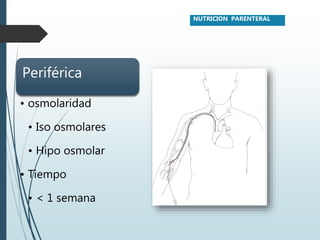 Periférica
• osmolaridad
• Iso osmolares
• Hipo osmolar
• Tiempo
• < 1 semana
NUTRICION PARENTERAL
 