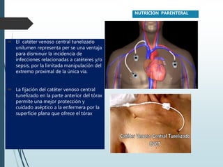 El catéter venoso central tunelizado
unilumen representa per se una ventaja
para disminuir la incidencia de
infecciones relacionadas a catéteres y/o
sepsis, por la limitada manipulación del
extremo proximal de la única vía.
 La fijación del catéter venoso central
tunelizado en la parte anterior del tórax
permite una mejor protección y
cuidado aséptico a la enfermera por la
superficie plana que ofrece el tórax
NUTRICION PARENTERAL
 