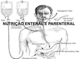 NUTRIÇÃO ENTERAL E PARENTERAL
 