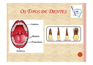 OS TIPOS DE DENTES
 