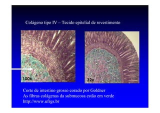 Colágeno tipo IV – Tecido epitelial de revestimento




Corte de intestino grosso corado por Goldner
As fibras colágenas da submucosa estão em verde
http://www.ufrgs.br
 